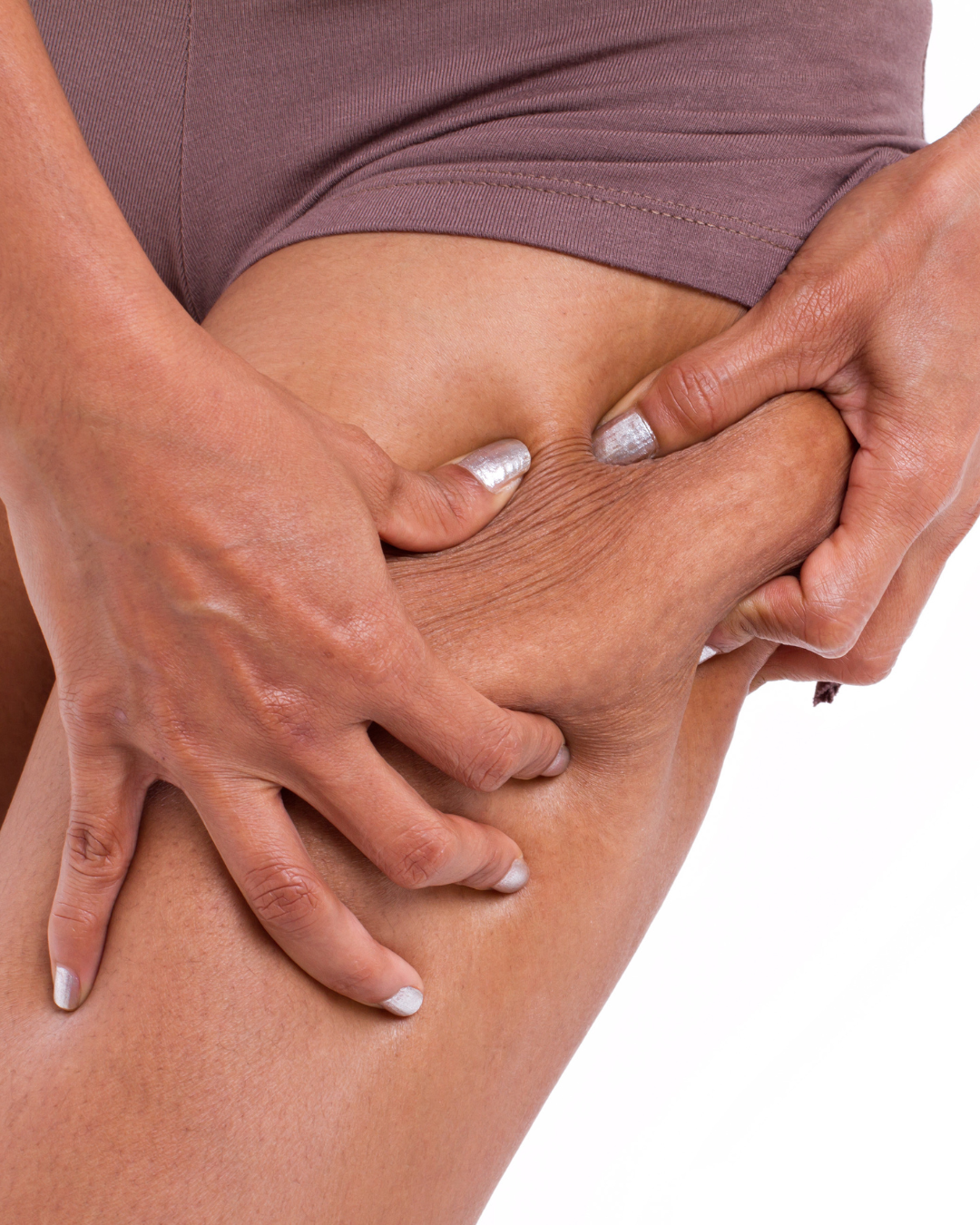 Cellulite Reduction Therapy 60 Minutes