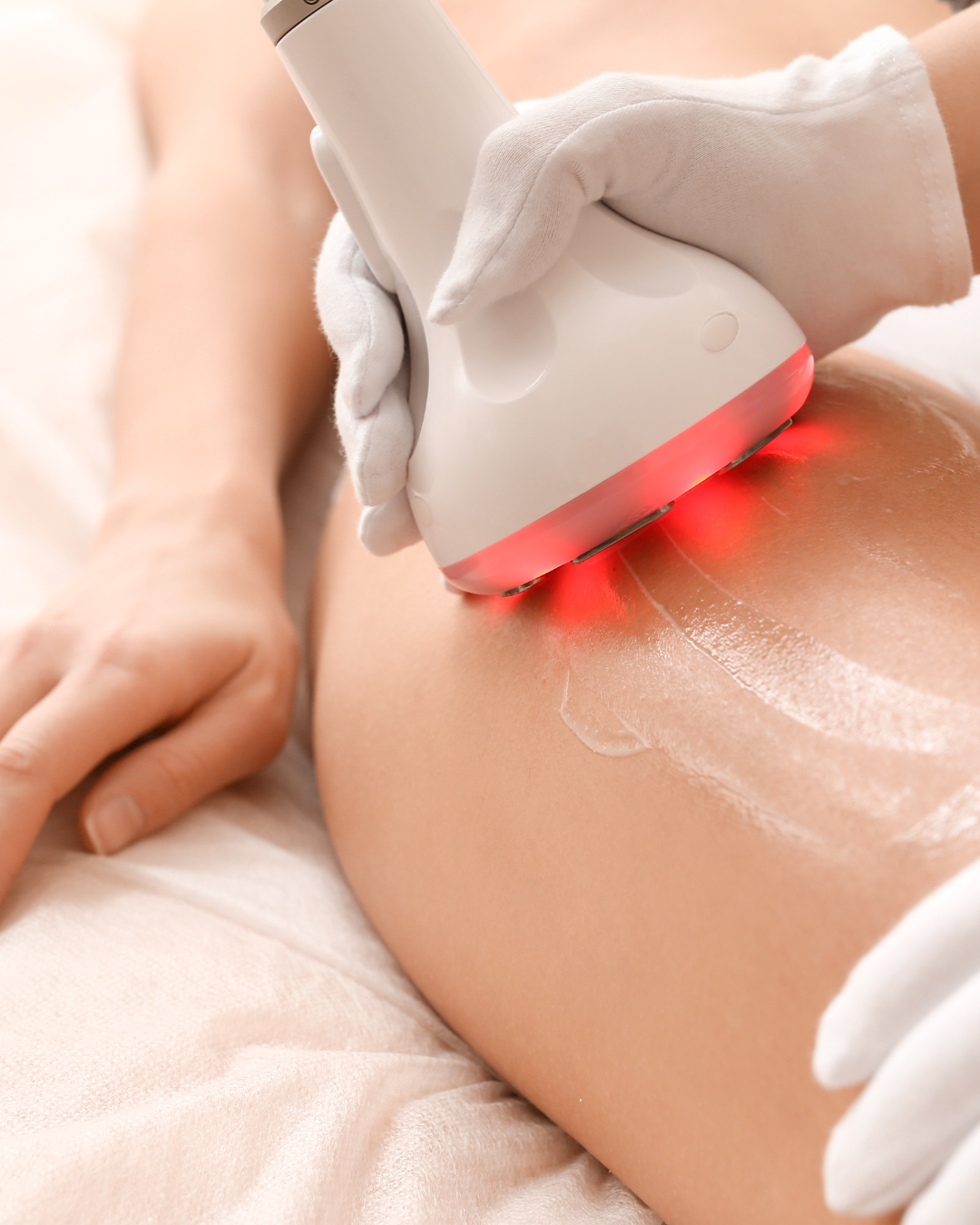 Cellulite Reduction Therapy Package